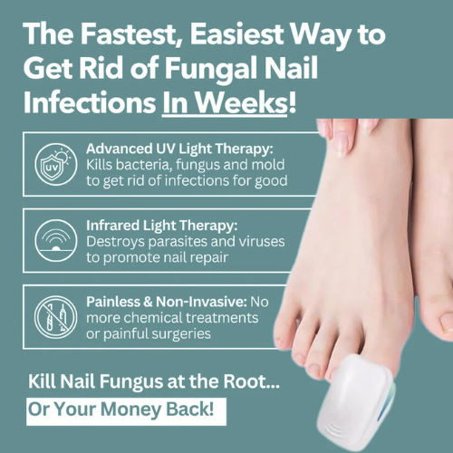 Buyera™ - Nail Fungus Laser Device