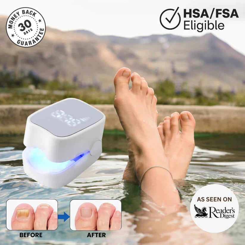 Buyera™ - Nail Fungus Laser Device